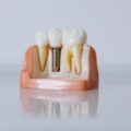 Este é o significado de sonhar com dentes