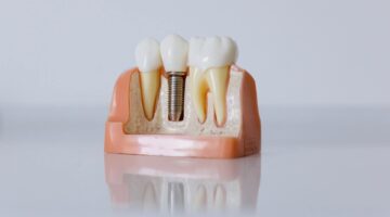 Este é o significado de sonhar com dentes